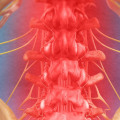 How long does it take for nerves to heal after spinal decompression?