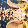 How painful is decompression surgery?
