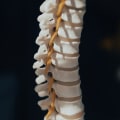 Suffering From Chronic Back Pain? Spinal Decompression Chiropractor In North York, Ontario Can Help