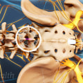 Is spinal decompression a major surgery?