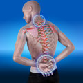 What is the purpose of spinal decompression?