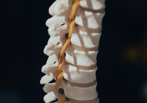 Suffering From Chronic Back Pain? Spinal Decompression Chiropractor In North York, Ontario Can Help